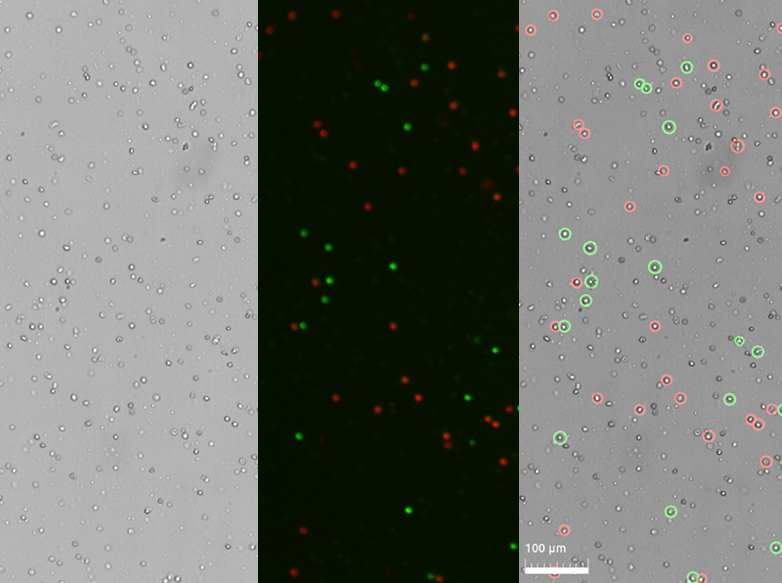 PBMC Logos Biosystems Advanced Imaging Solutions For Research