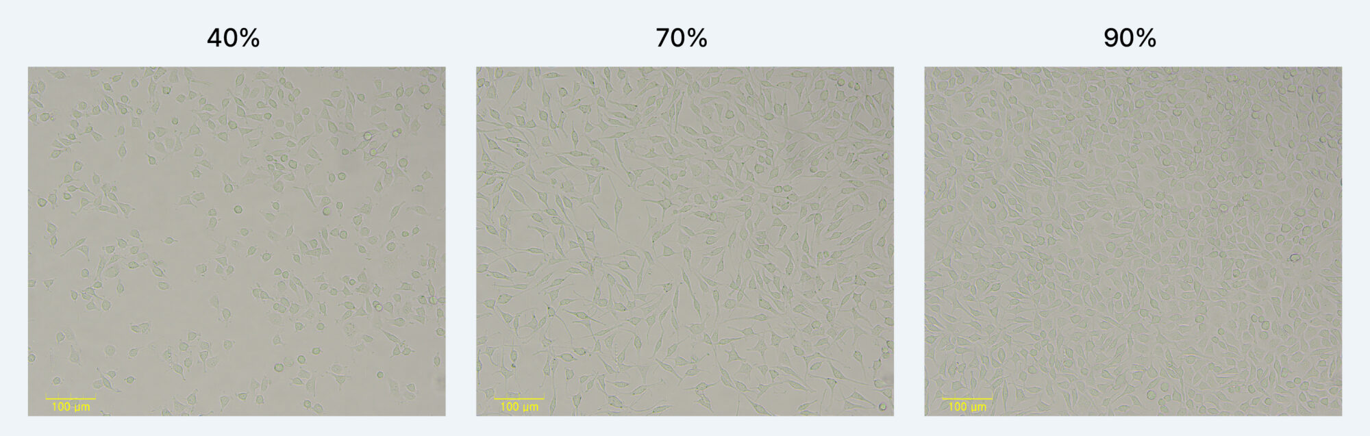 Representative Cell Culture Images at Different Confluence Levels (e.g., 40%, 70%, 90%)