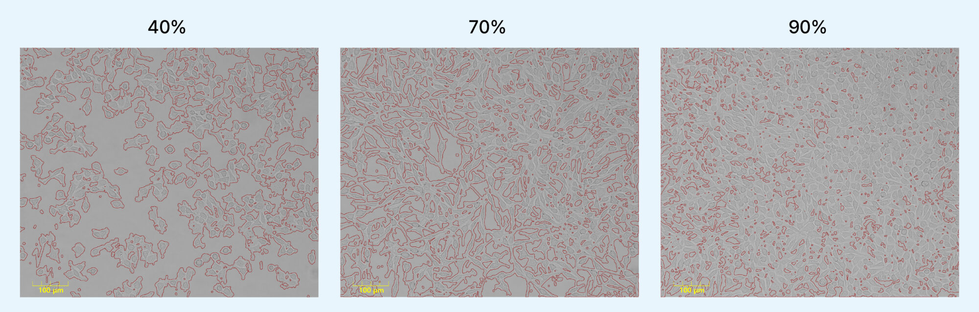 Example of Confluence Analysis (Detection of Cell-Covered Regions)