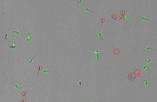 LogosBiosystems_sperm cell counting with the LUNA-FX7 automated cell counter_500x325